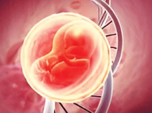 Placenta Accreta Spectrum Workshop