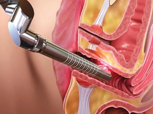 Laser and Energy-Based Devices in Cosmetic Gynecology Workshop